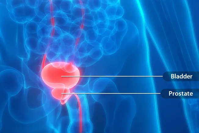 Overactive Bladder & Urinary Incontinence